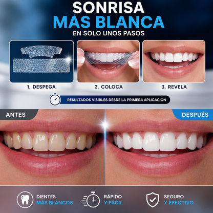 LUMI SMILE (tiras blanqueadoras dentales)