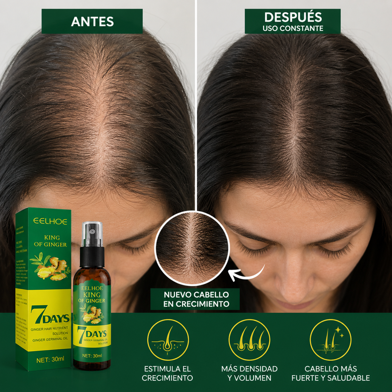 DERMA GROW GINGER (aceite de crecimiento capilar)
